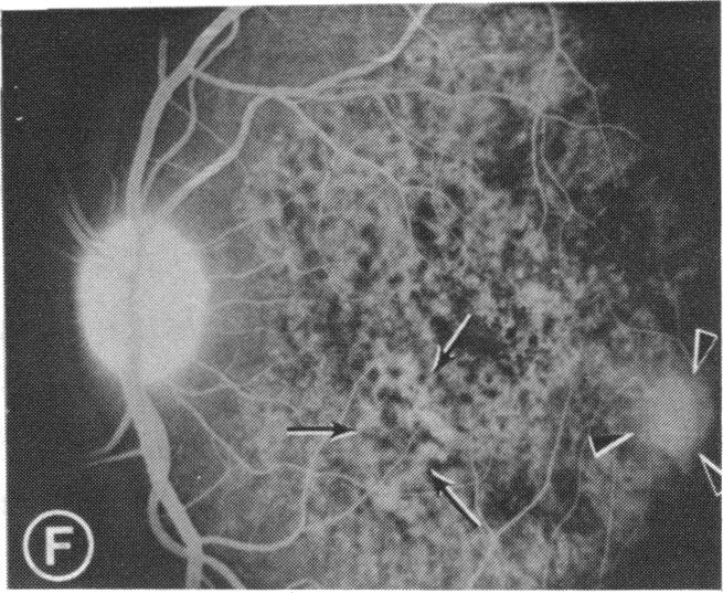 FIGURE 5 F