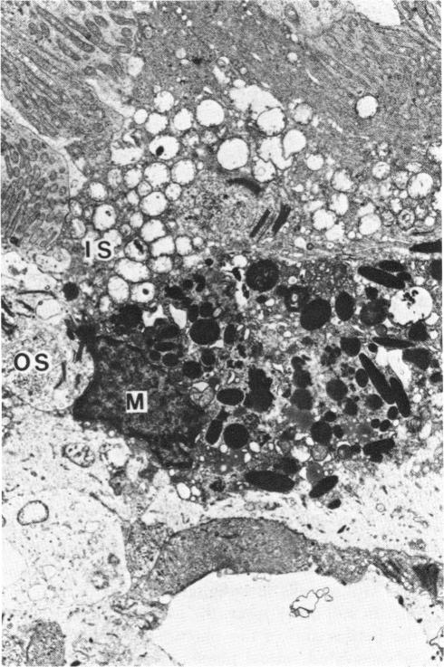 FIGURE 21