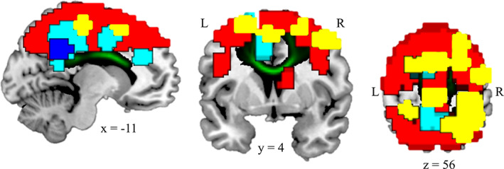 FIGURE 2