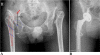 Fig. 1A–B
