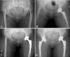 Fig. 2A–D