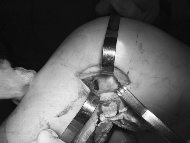 Fig. 6