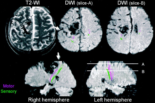 Fig 2.