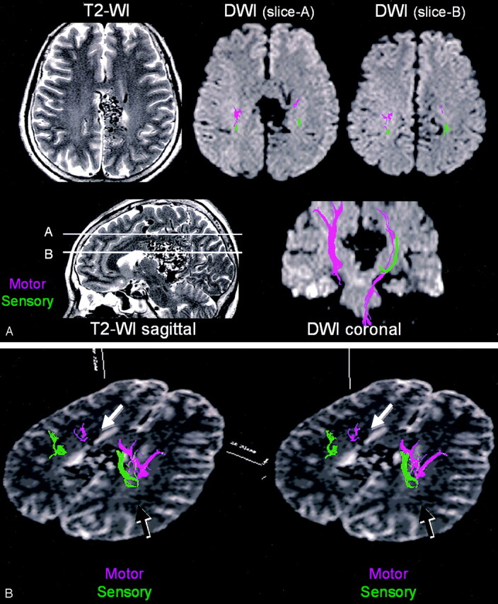 Fig 4.