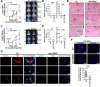 Figure 6. Downregulation of IL13Rα2 reduces brain metastatic progression. A, Female NSG mice were injected intracardially with 175.000 231BR-EV (n = 10) or shIL13RA2 cells (N = 9) expressing luciferase, and cells were allowed to seed and colonize for 7 days before induction with doxycycline. Brain metastatic burden was measured via in vivo imaging immediately after cell injection and the indicated times. Head total flux for each animal was normalized to brain signal at time 0 (Fold Change FC). Left, Graph shows Log-transformed FC ± SEM over time for EV versus shIL13RA2-injected mice. Arrow indicates start point for doxycycline treatment. Normally distributed Log-transformed FC values were analyzed using Repeated Measures Mixed effects. Right, Representative image of brain metastatic burden in mice injected with shEV and shIL13RA2. ***, P = 0.0007 at the indicated time point. B, Histologic quantification of BMs from mice in A. Left, Each dot represents the median number of micrometastases (<300 μm) per mouse, and the line designates the group median. Right, Each dot represents the total number of metastatic clusters per mouse. Data were analyzed using the Mann–Whitney test. C, Female NSG mice were injected as in A (n = 10/group), but cells and mice had been pretreated with doxycycline for 2 days before cell injection. Left, Graph shows Log-transformed FC ± SEM over time for EV versus shIL13RA2 injected mice. Normally distributed Log-transformed FC values were analyzed using Repeated Measures Mixed effects. *, P = 0.045; **, P = 0.0052 at the indicated time points. Right, Representative image of brain metastatic burden in mice injected with shEV and shIL13RA2 in this experiment. D, Histologic quantification of BMs for mice in C surviving at day 19 (n = 7 for EV, N = 10 for shIL13RA2). E, Representative images of BM in EV versus shIL13RA2 from A to B. Blue arrows denote BMs with a “less invasive” growth pattern, black arrows BMs with invasive fronts. F, Mice from A were injected with BrdUrd 2 hours before euthanasia, and BrdUrd incorporation in BMs was quantified by IF. Top, Representative image of BrdUrd staining in macro- and micromets from EV versus shIL13RA2 mice. Bottom, Percentage of BrdUrd+ cells quantified in individual metastases from four mice with histologically detectable BMs per group. G, Double-IF staining of p-FAK (red) and ephrin B1 (green) in BMs from EV versus shIL13RA2 mice. Blue is DAPI.