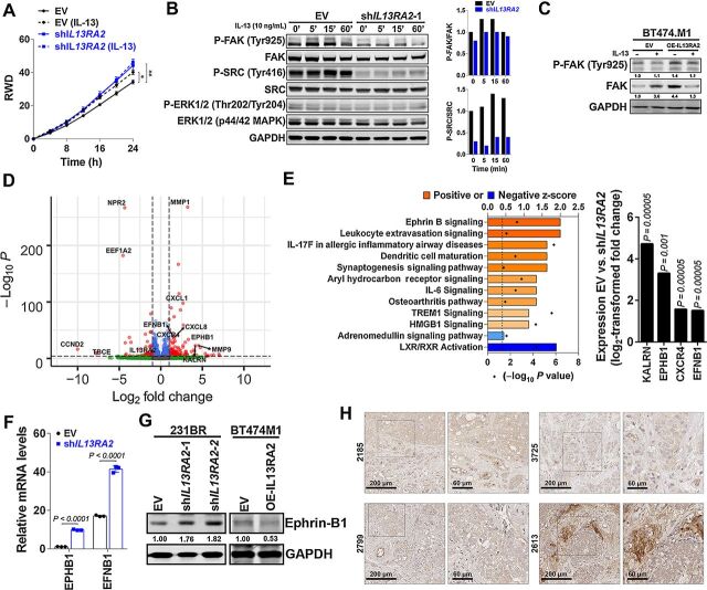 Figure 4. Downregulation of IL13RA2 decreases FAK/SRC but upregulates Ephrin B signaling. A, 231BR cells expressing EV or shIL13RA2 were induced with doxycycline for 48 hours, and treated with vehicle or 10 ng/mL human recombinant IL-13 (hrIL-13) in an invasion assay. Graph shows relative wound density (RWD) over time (n = 6–10 wells per group), in a modified Matrigel-filled scratch-wound assay. Data analyzed with repeated measures ANOVA followed by multiple comparison post hoc corrections. Adjusted P value at last time point *, P < 0.05; **, P < 0.01. B, WB show signaling pathways in 231BR EV or shIL13RA2 cells induced with doxycycline for 72 hours, serum starved overnight, and then treated with 10 ng/mL hrIL-13 for the indicated times. Plot shows quantification of pFAK/FAK and P-SRC/SRC from two independent experiments. C, WB shows P-FAK and FAK in BT474.M1 cells expressing EV or OE-IL13RA2, induced with doxycycline for 72 hours and treated with vehicle or 10 ng/mL hrIL-13 for 5 minutes. GAPDH is loading control. D, Global RNA sequencing was performed in doxycycline-induced 231BR EV versus 231BR shIL13RA2 cells 48 hours after doxycycline induction (n = 3/group). Volcano plot shows differentially expressed genes in EV versus shIL13RA2 cells. Red dots are genes with log2 FC>1.5 and P < 0.05. E, Ingenuity Pathway Analysis (IPA). The P value (calculated with Fischer's exact test) and Z-score were determined to establish any probable association between our set of genes and a specific pathway. Left, Ephrin B signaling is the only pathway modulated in shIL13RA2 cells with a significant P value and ≥2 positive Z-score. Right, The log2-transformed fold change in expression of upregulated genes in the Ephrin B1 signaling pathway (KALRN, EPHB1, CXCR4, and EFNB1). F, Relative mRNA expression of EphB1 receptor (EPHB1) and ephrin B1-ligand (EFNB1) in EV versus shIL13RA2 231BR cells (n = 3). G, WB shows ephrin B1 expression in 231BR expressing EV or shIL13RA2, and BT474 cells expressing EV or OE-IL13RA2. GAPDH was used as loading control. Numbers show ephrin B1 levels normalized to GAPDH and relative to EV control. H, IHC staining of ephrin B1 expression in BCBMs. Representative images of the tumor invasive front in late BM are shown in zoom-in.