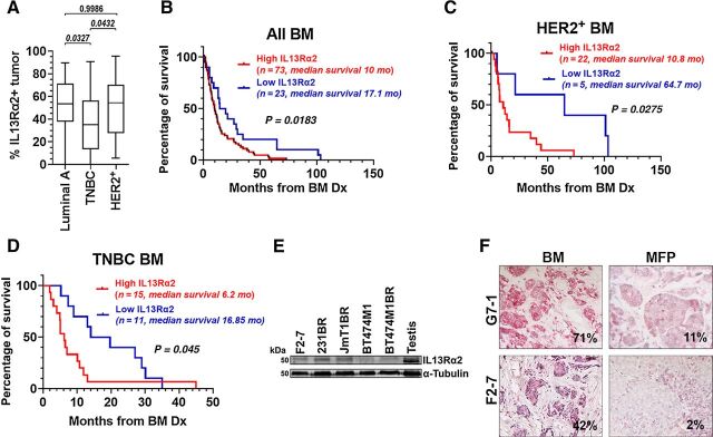 Figure 1. IL13Rα2 expression is high in BM, and increased levels predict worse survival after brain metastasis diagnoses. A, IL13Rα2 IHC staining was scored using Aperio Digital Imaging, and tumoral areas with strong intensity scores were considered positive. Graph shows percentage of positive tumor area for a cohort of BM samples from Luminal A (n = 32), HER2+ (n = 27), and TNBC (n = 26) breast cancer subtypes. Data were analyzed using ANOVA. Adjusted P value is shown. B, All BMs (n = 96) were classified as high (≥25% + tumor, blue) versus low IL13Rα2 (<25% + tumor, red), and percentage of survival following BM diagnoses was plotted. C, HER2+ BMs (n = 27) were classified as high or low IL13Rα2 as in B. D, TNBC BMs (N = 26) were classified as high or low IL13Rα2 expression as in B. Kaplan–Meier curves (B–D) were analyzed using the log-rank test. E, WB shows IL13Rα2 expression in breast cancer cells. F, The percentage of tumoral area expressing IL13Rα2 in clinical BM (F2–7, G7–1) as compared with the same tumors growing as PDXs in the mammary fat pad (MFP) of NSG mice.