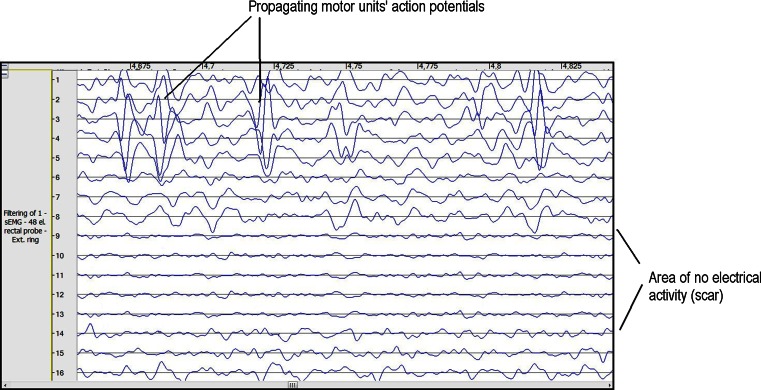 Fig. 2