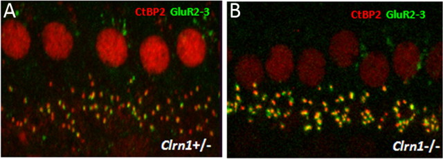 Figure 11.