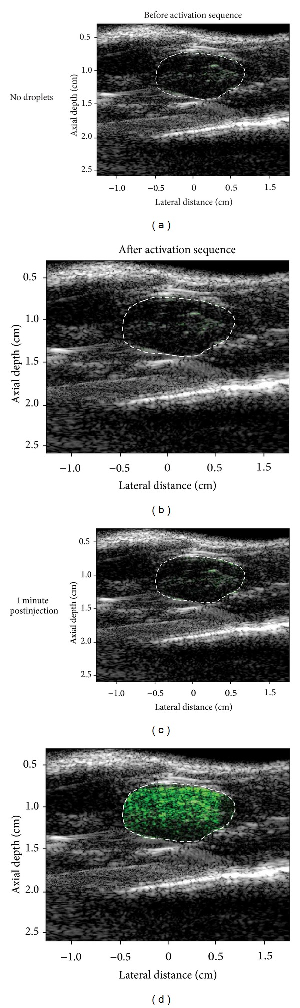 Figure 14