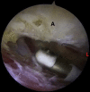Fig 5