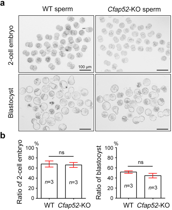 Figure 7—figure supplement 3.