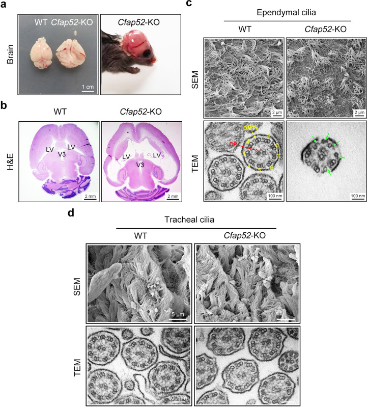 Figure 4—figure supplement 2.