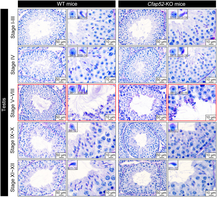 Figure 4—figure supplement 4.