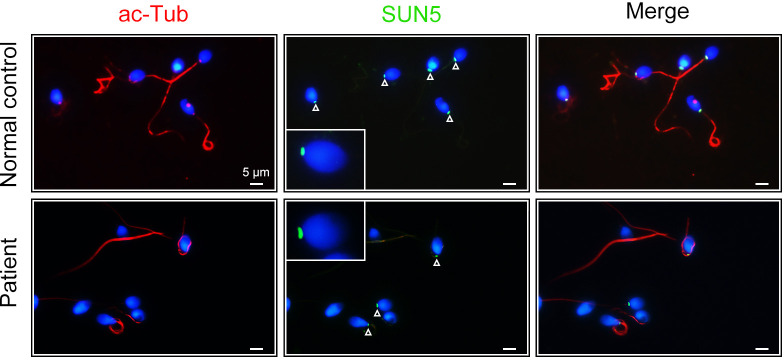 Figure 6—figure supplement 1.