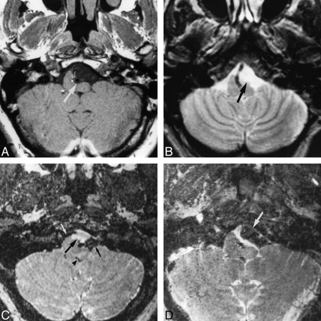 fig 3.