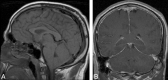 Fig 1.