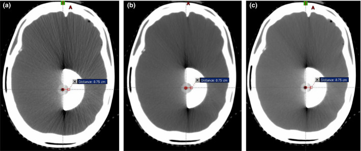 FIG. 5