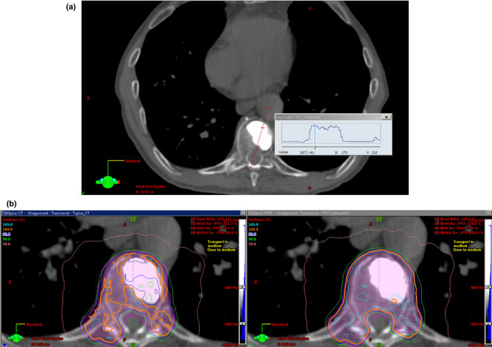 FIG. 13