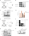 Figure 1. Genome-wide trametinib-resistance screen identifies MAML2 and MAP3K1. A, Schematic overview of genome-wide trametinib resistance screen in VOA-6406dCas9MS2 cell line with the SAM library targeting 23,430 isoforms for transcriptional activation. Cells were infected with MOI below 0.5 and 250× representation of guides. Trametinib selection was performed for 3 weeks, after which gRNA abundance was determined in treated (tr) over untreated (ut) conditions through deep sequencing. Screens were performed in triplicate. Validated hit MAML2 is highlighted in the bubble plot presentation of the DESeq2/RRA MAGeCK analysis. FDR threshold <0.1. B, The functional phenotypes of lentiviral SAM1.2-gMAML2 vectors (#1 and #2) in the VOA-6406 dCas9MS2 cell line upon trametinib treatment was measured in a long-term colony-formation assay. Cells expressing an empty pSAM1.2 vector were used as control. The cells were fixed, stained, and scanned after 14 days. C, Western blot analysis of the VOA-6406 dCas9MS2 cell line transduced with lentiviral SAM1.2 and SAM1.2-gMAML2#2 and exposed to 0, 2, and 5 nmol/L trametinib for 3 days. Blots were probed with the indicated antibodies. HSP90 was used as a loading control. D, VOA-6406dCas9MS2 cells transduced with SAM1.2 and SAM1.2gMAML2#2 were subjected to mRNA expression analysis with QRT-PCR. mRNA levels were normalized to the expression of GAPDH and displayed is the relative expression of the indicated mRNAs. Error bars denote SD. E, Schematic overview of genome-wide trametinib-resistance screen in VOA-6406 cell line with the Brunello library targeting 19,114 genes. Cells were infected with MOI below 0.5 and 250× representation of guides. Trametinib selection was performed for 3 weeks, after which gRNA abundance was determined in treated (tr) over untreated (ut) conditions through deep sequencing. Screens were performed in triplicate. Validated hit MAP3K1 is highlighted in the bubble plot presentation of the DEseq2/RRA MAGeCK analysis. FDR threshold <0.1. F, Colony-formation assays were performed with selected VOA-6406 monoclonal cell lines transduced with gCTRL#1 (nontargeting region in chromosome 5), gCTRL#2 (nontargeting region in chromosome 9), and gMAP3K1#1 and gMAP3K1#2. Plated cells were exposed to increasing trametinib concentrations as indicated. The cells were fixed, stained, and scanned after 10 days. Colony-formation assays were performed in triplicate, and a representative staining is shown. G, Western blot analysis of total lysates generated from the monoclonal gCTRL (#1 and #2) and gMAP3K1 (#1 and #2) lines exposed to 0, 2, and 10 nmol/L trametinib for 1 day. Blots were probed with the indicated antibodies. H, Western blot analysis of the VOA-6406 dCas9MS2 cell line transduced with lentiviral SAM1.2 and SAM1.2-gMAML2#2 and the VOA-6406 monoclonal lines gCTRL (#1 and #2) and gMAP3K1 (#1 and #2). Blots were probed with the indicated antibodies.