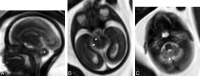 Fig 1.