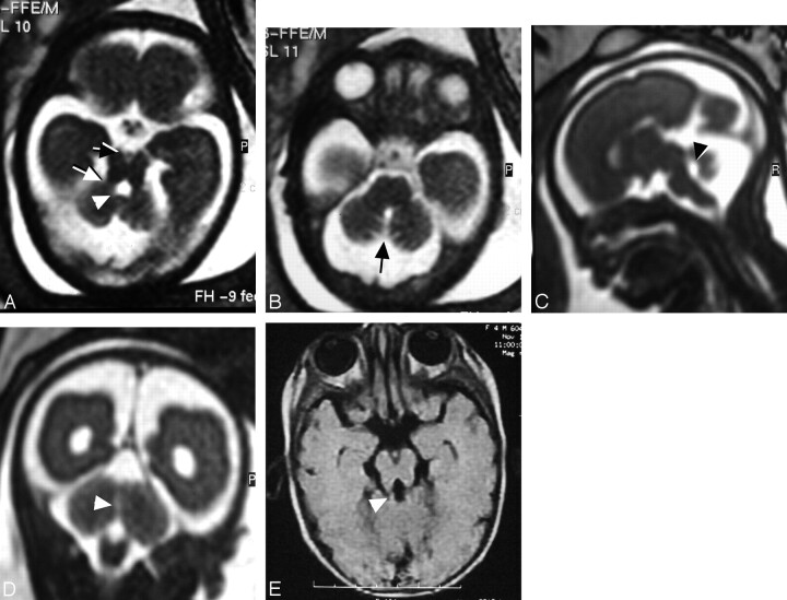 Fig 2.