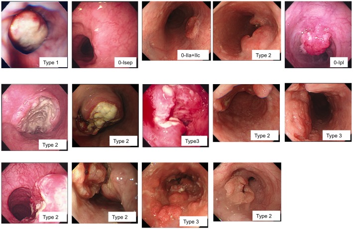 Fig 1