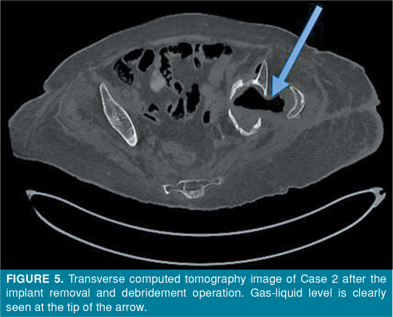 Figure 5