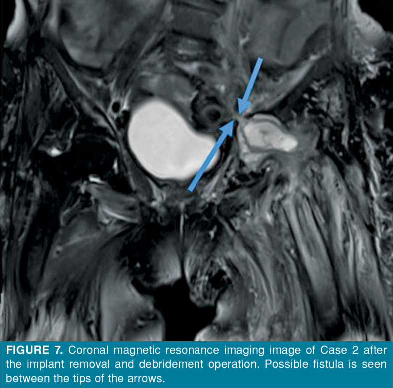 Figure 7