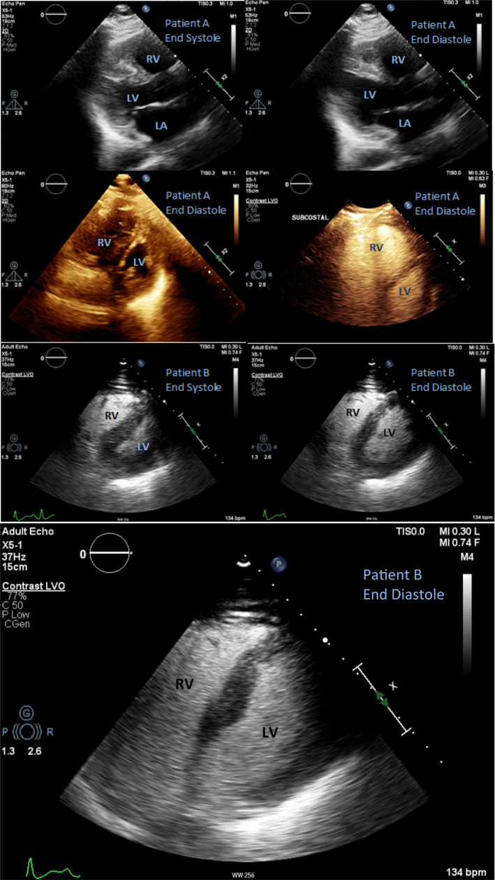 FIGURE 1