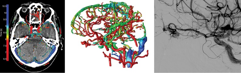 Fig 3.