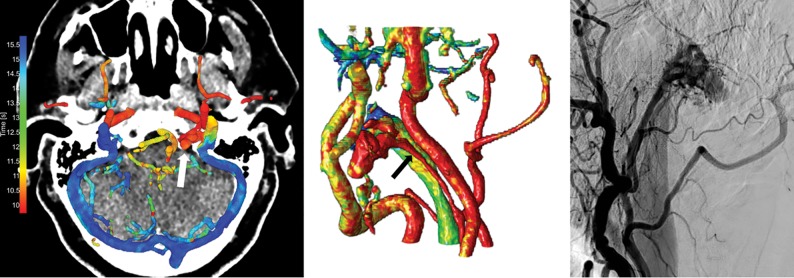 Fig 4.