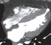 Figure 21