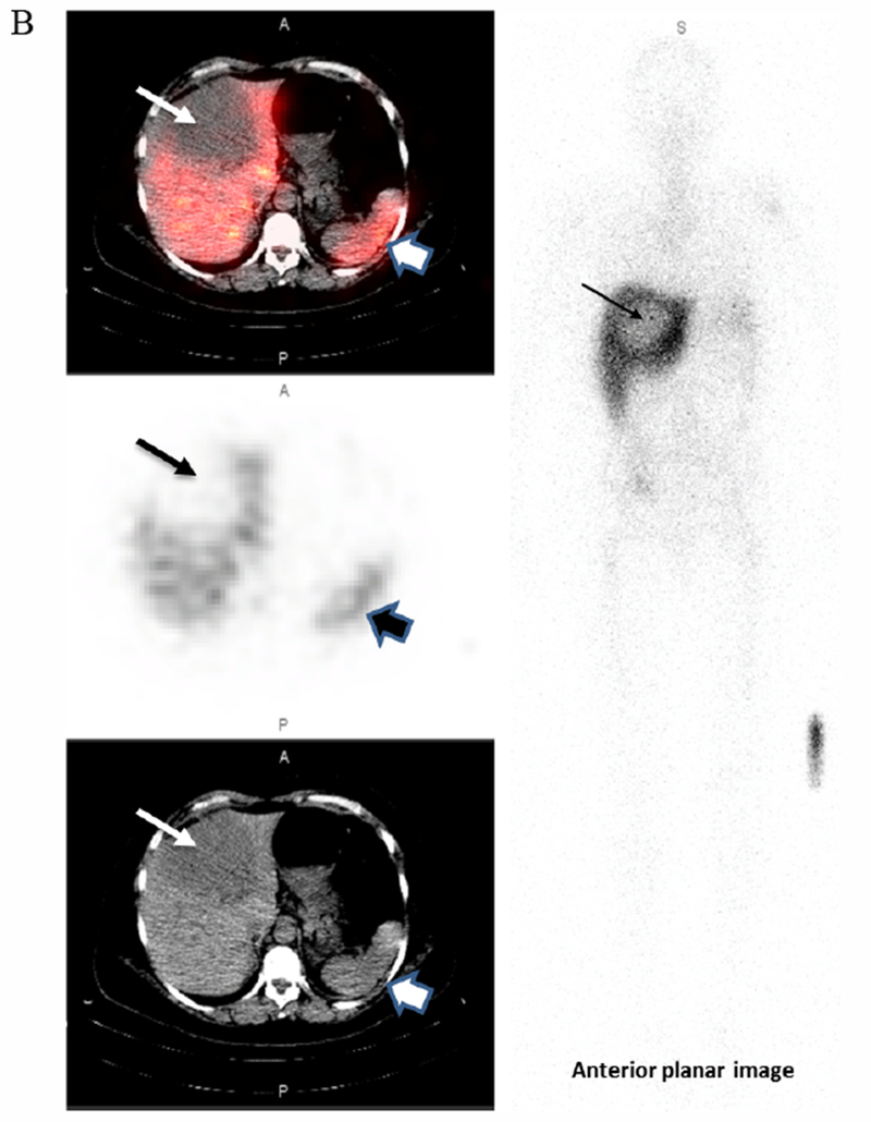 Figure 3B.