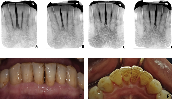 Fig. 1