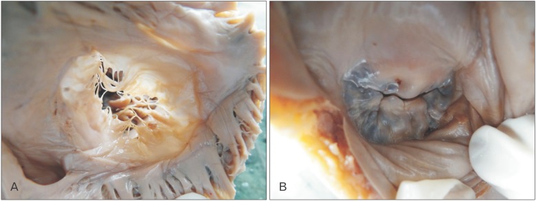 Fig. 5