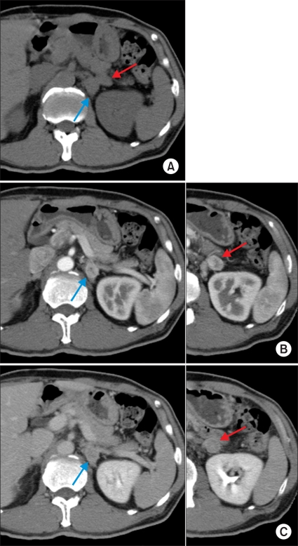 FIG. 1