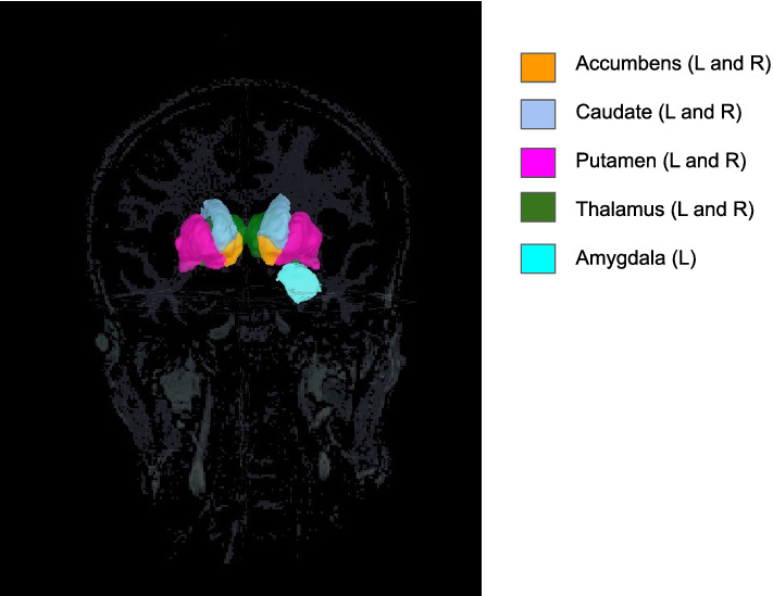 Fig. 12