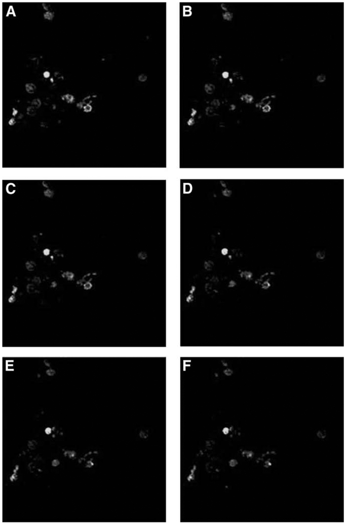 Fig. 11.