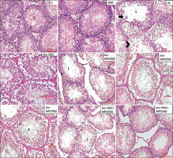 Ameliorating Effect Of Mucuna Pruriens Seed Extract On Sodium Arsenite 