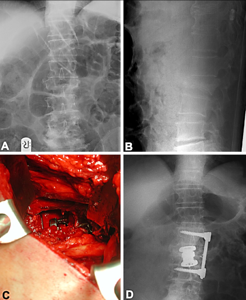 Fig. 4A-D