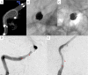 Fig. 4