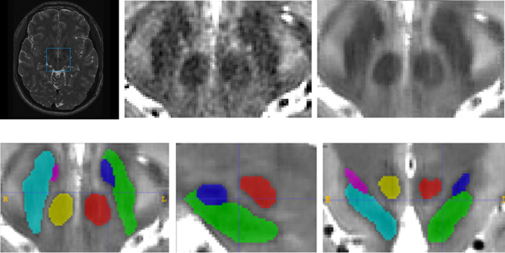 Fig. 2