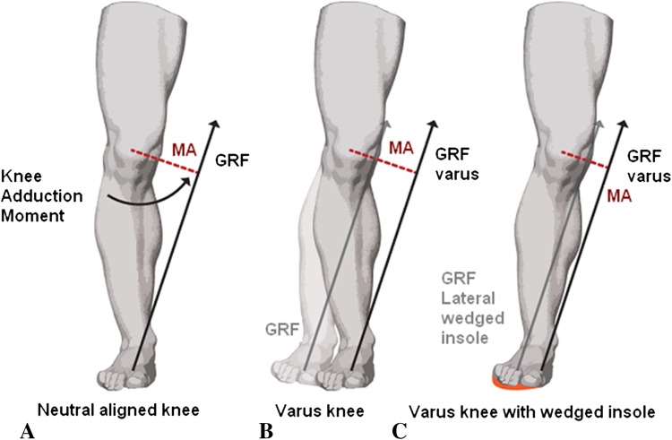 Fig. 4A–C