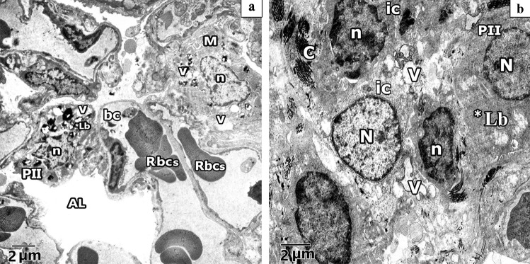 Fig. 12