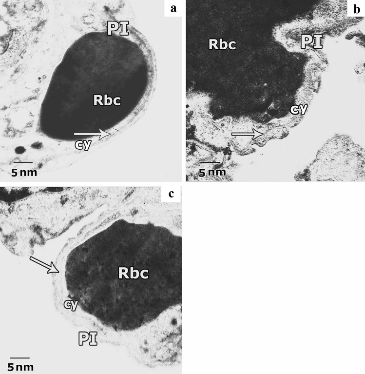 Fig. 15