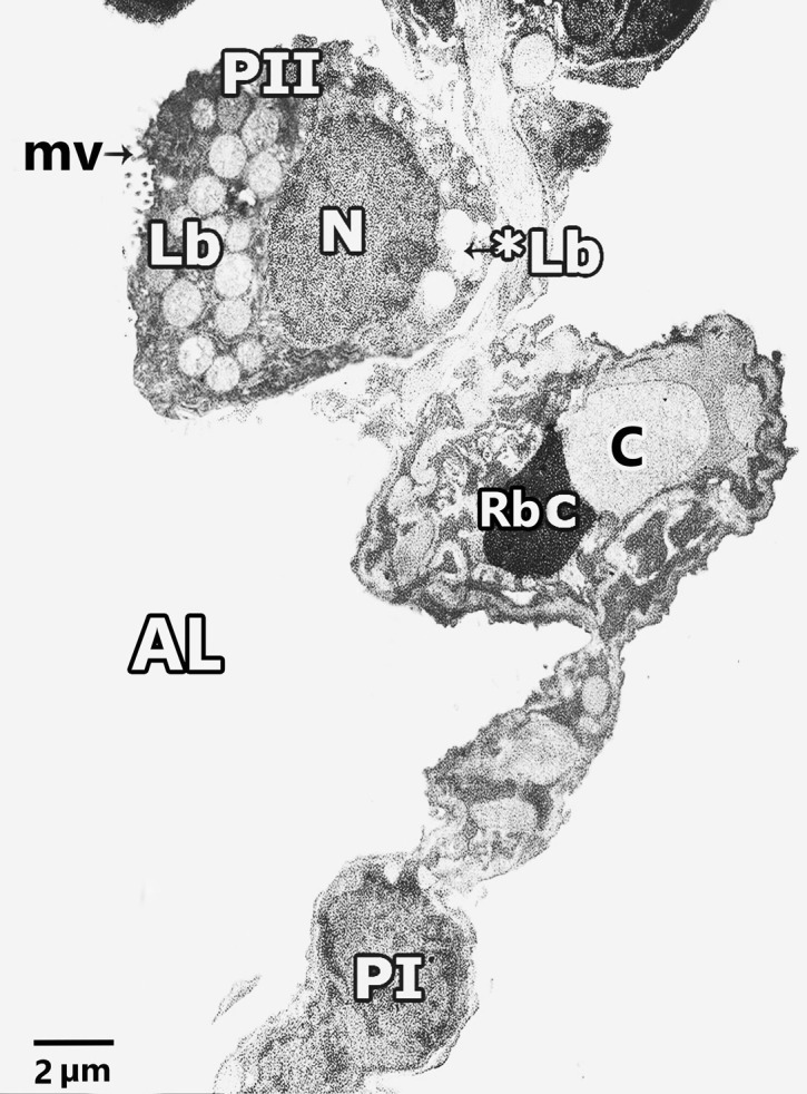 Fig. 11