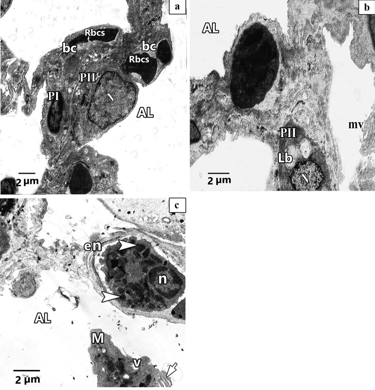 Fig. 14