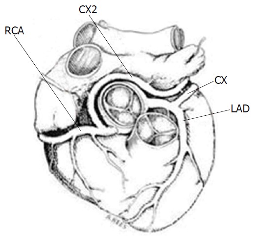 Figure 17