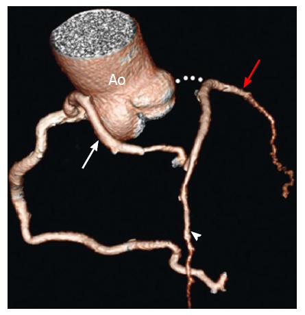 Figure 18